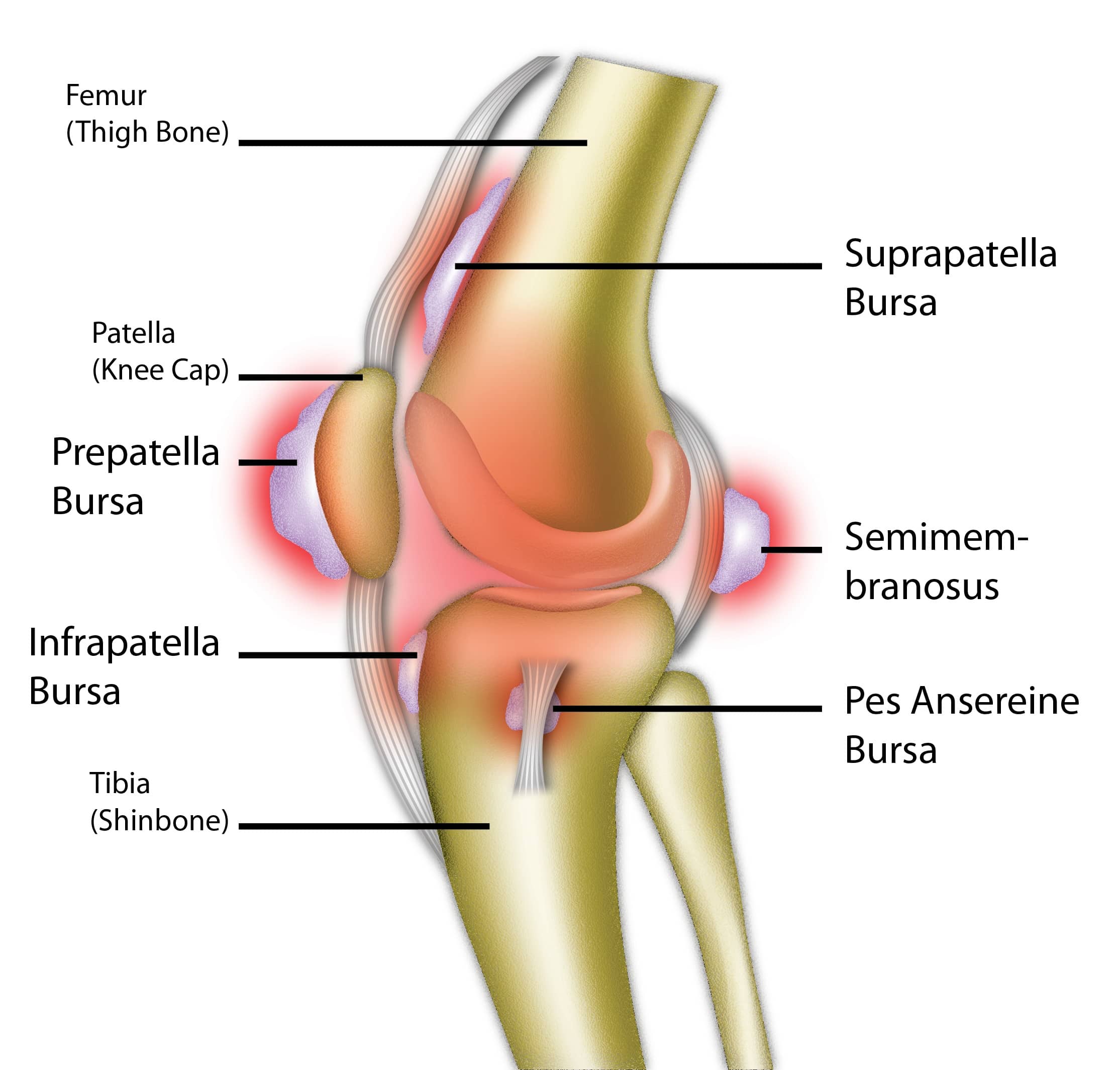 bursa infrapatellaris superficialis cauzele bolii articulațiilor genunchiului și tratamentul acestora