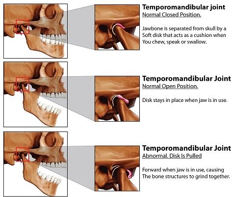 Temporomandibular_Joint-min[1]