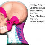Cervicogenic Headache